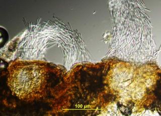 Tiny rice-noodle like septoria spores emerge from ripe pycnidia.