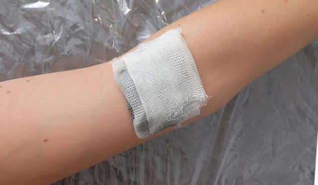 Gauze dressing held against a forearm
