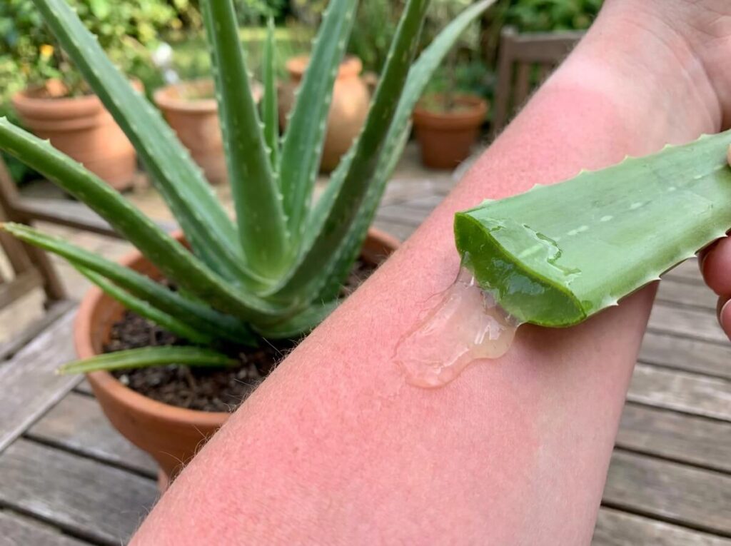 Fresh aloe vera leaf broken open revealing thick clear gel on sunburned skin